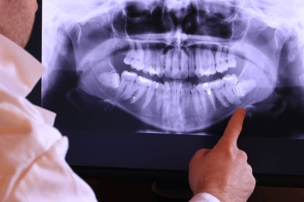 Best Emergency Dental Services for Seniors in Elmwood Place, OH
